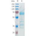 Human FCMR Protein, hFc Tag – Figure 1 of 1
