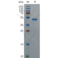 Human GDNF Protein, hFc Tag – Figure 1 of 1