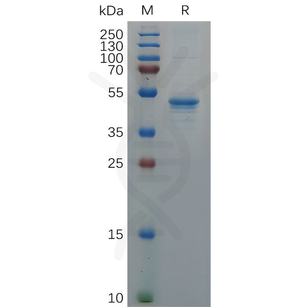Human GDNF Protein, hFc Tag – Figure 1 of 1