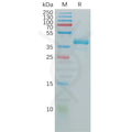 Human GNRHR Protein, hFc Tag – Figure 1 of 1