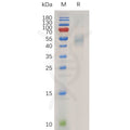 Human IL13 Protein, hFc Tag – Figure 1 of 1