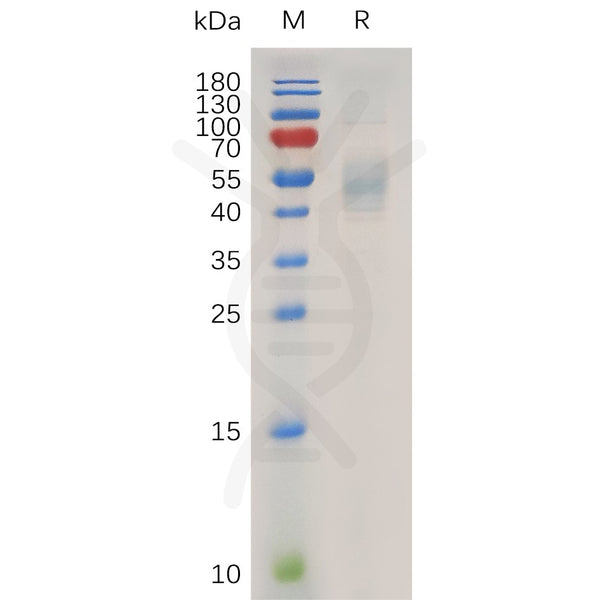 Human IL13 Protein, hFc Tag – Figure 1 of 1