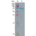 Human IL10 Protein, hFc Tag – Figure 1 of 1