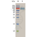 Human IL10R Protein, hFc Tag – Figure 1 of 1