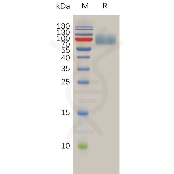 Human IL10R Protein, hFc Tag – Figure 1 of 1