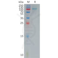 Human IL12RB1 Protein, His Tag – Figure 1 of 1