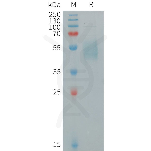 Human IL15 Protein, hFc Tag – Figure 1 of 1