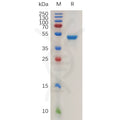 Human IL17B Protein, hFc Tag – Figure 1 of 1