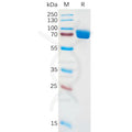 Human IL1RA Protein, hFc Tag – Figure 1 of 1
