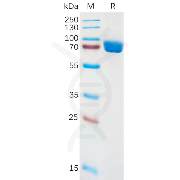 Human IL1RA Protein, hFc Tag – Figure 1 of 1
