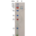 Human MAGEA4 Protein, His Tag – Figure 1 of 1