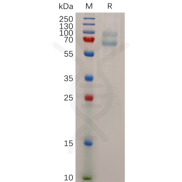 Human MAGEA4 Protein, His Tag – Figure 1 of 1
