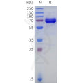Human ACPP Protein, hFc Tag – Figure 1 of 1