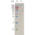 Human BRD4 Protein, hFc Tag – Figure 1 of 1