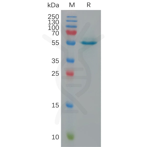 Human CALR Protein, His Tag – Figure 1 of 1