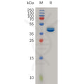 Human CCL2 Protein, hFc Tag – Figure 1 of 1