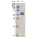 Human CCR1 Protein, hFc Tag – Figure 1 of 1