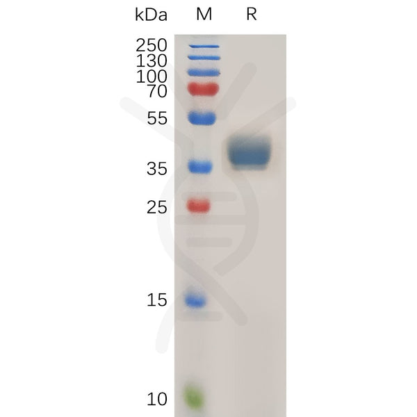 Human CCR1 Protein, hFc Tag – Figure 1 of 1