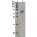 Human CCR2 Protein, hFc Tag – Figure 1 of 1