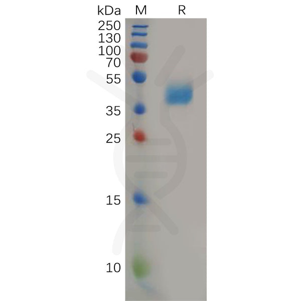 Human CCR2 Protein, hFc Tag – Figure 1 of 1