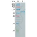 Human CCR5 Protein, hFc Tag – Figure 1 of 1