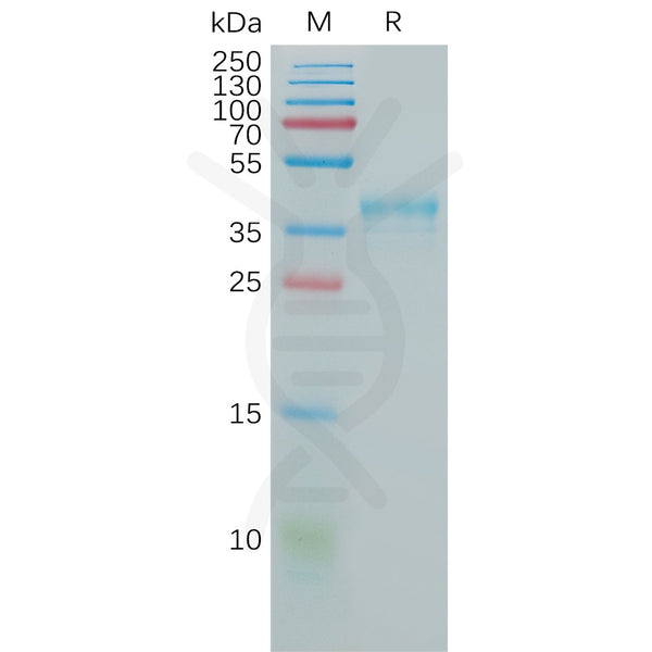 Human CCR5 Protein, hFc Tag – Figure 1 of 1
