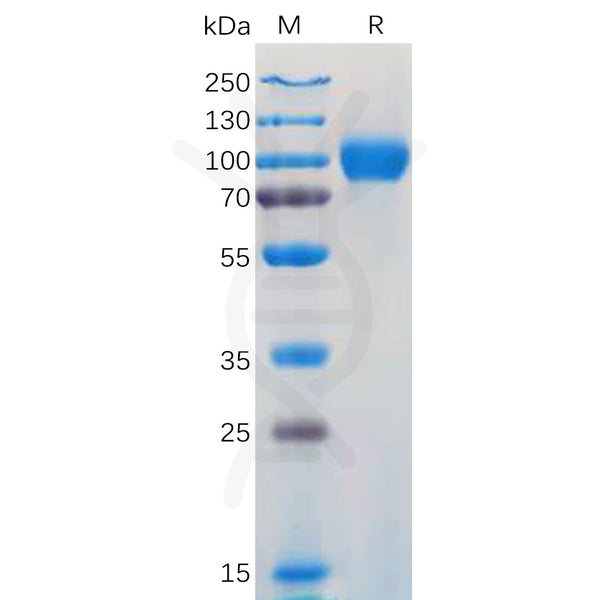 Human GM-CSFR Protein, hFc Tag – Figure 1 of 1