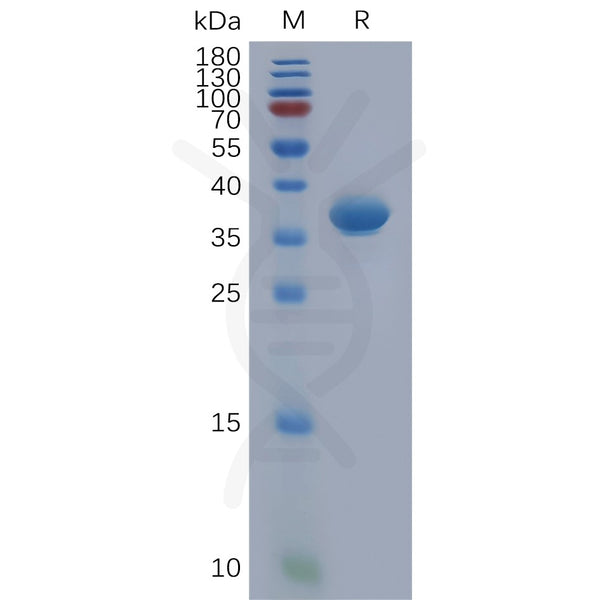 Human CXCL1 Protein, hFc Tag – Figure 1 of 1
