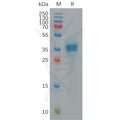 Human CXCL9 Protein, hFc Tag – Figure 1 of 1