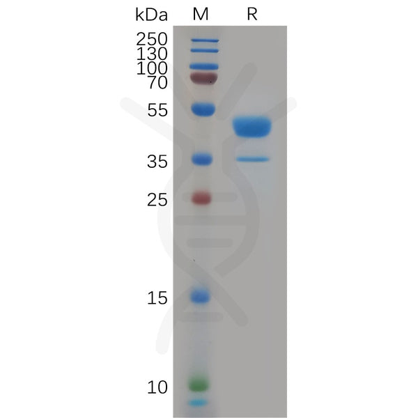 Human CXCR2 Protein, hFc Tag – Figure 1 of 1