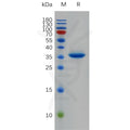 Human EGF Protein, hFc Tag – Figure 1 of 1