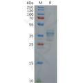 Human GAST Protein, hFc Tag – Figure 1 of 1