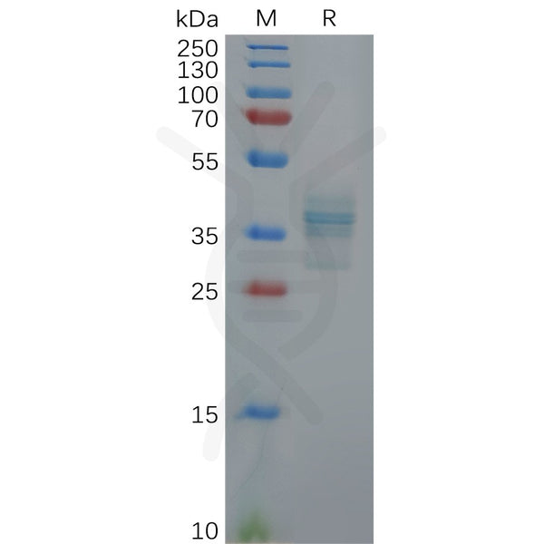 Human GAST Protein, hFc Tag – Figure 1 of 1