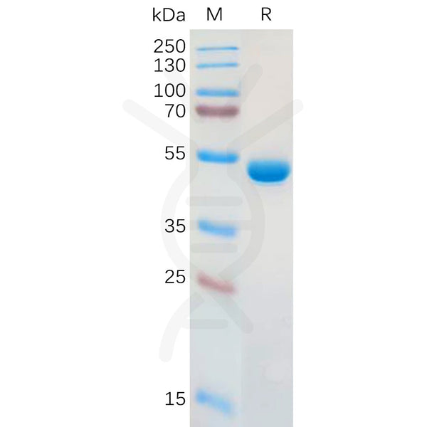 Human LGALS1 Protein, hFc Tag – Figure 1 of 1