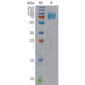 Human IFNAR1 Protein, His Tag – Figure 1 of 1