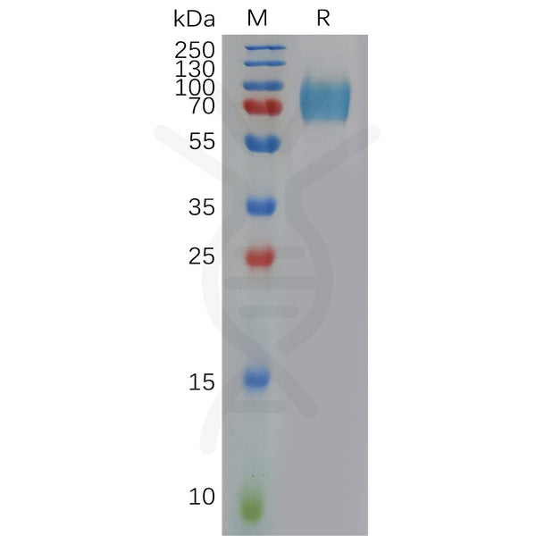 Human IFNAR1 Protein, His Tag – Figure 1 of 1