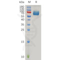 Human IFNAR2 Protein, hFc Tag – Figure 1 of 1
