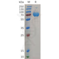 Human IFNGR2 Protein, hFc Tag – Figure 1 of 1