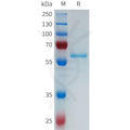 Human KLK3 Protein, hFc Tag – Figure 1 of 1