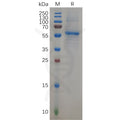 Human KRAS Protein, hFc Tag – Figure 1 of 1