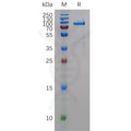 Human MMP11 Protein, hFc Tag – Figure 1 of 1