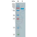 Human MMP2 Protein, His Tag – Figure 1 of 1