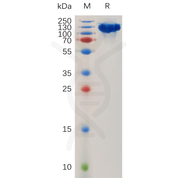 Human ROBO1 Protein, hFc Tag – Figure 1 of 1