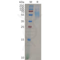 Human SIGLEC9 Protein, His Tag – Figure 1 of 1