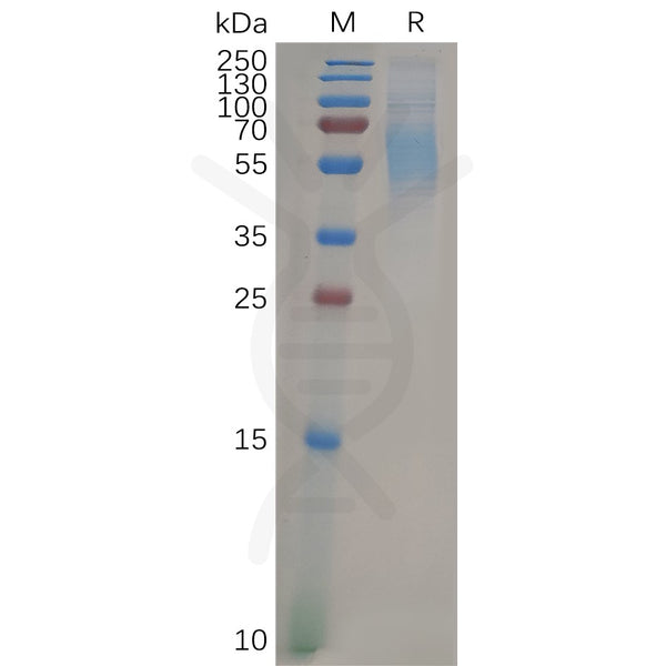 Human SIGLEC9 Protein, His Tag – Figure 1 of 1