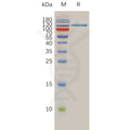 Human SPAM1 Protein, hFc Tag – Figure 1 of 1