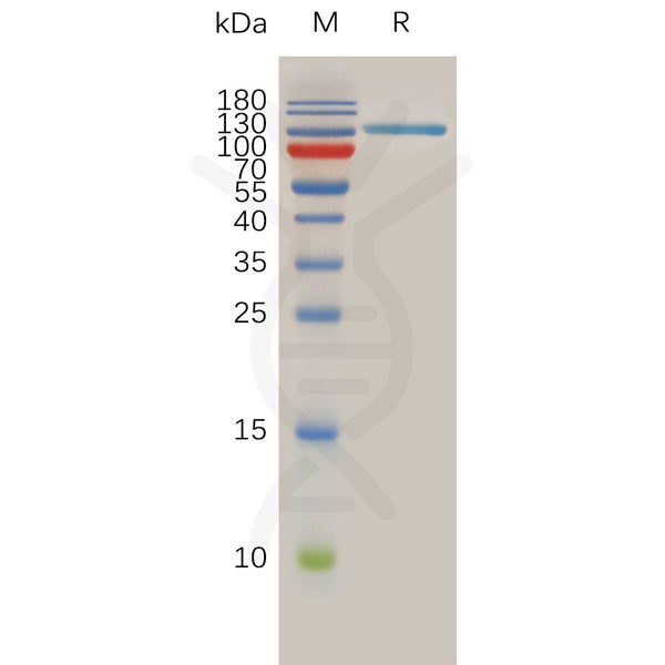 Human SPAM1 Protein, hFc Tag – Figure 1 of 1