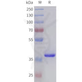 Human TGFB2(303-414) Protein, hFc Tag – Figure 1 of 1