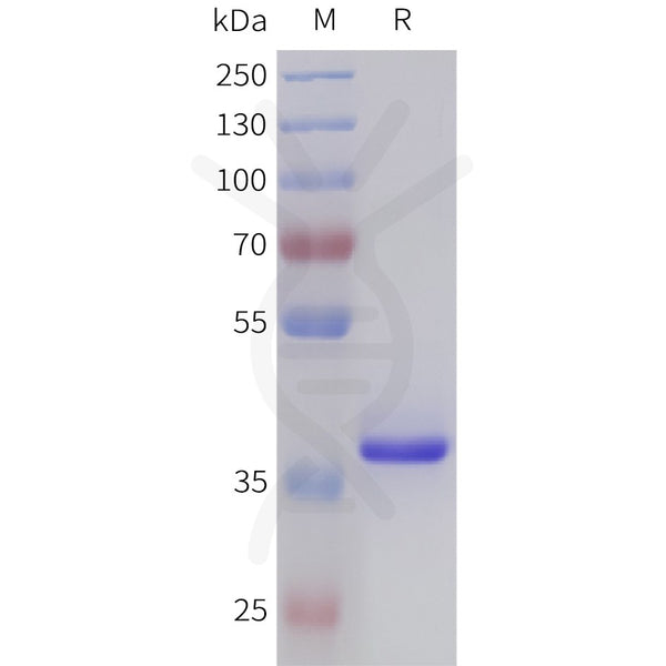 Human TGFB2(303-414) Protein, hFc Tag – Figure 1 of 1