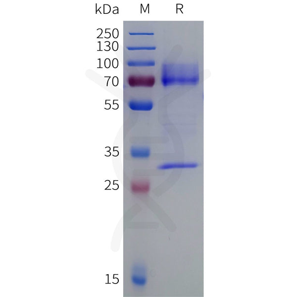 Human TGFB3 Protein, hFc Tag – Figure 1 of 1